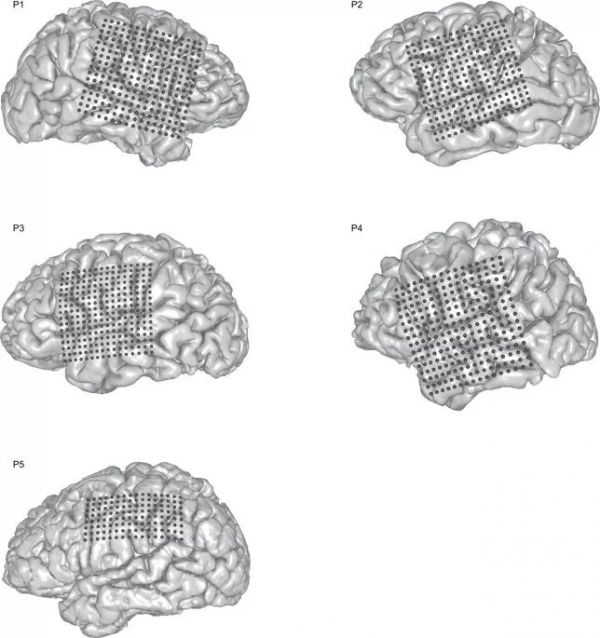 Nature重磅：华裔科学家成功解码脑电波，AI直接从大脑中合成语音