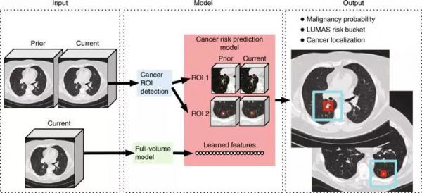 谷歌：AI预测肺癌，准确率高于医生