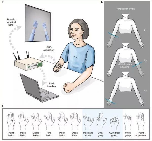 意念加AI算法「复原」每个手指，智能义肢登上Nature子刊封面