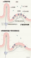 食物中毒后,谁在默默帮你抵御细菌感染?