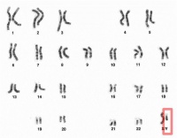 染色体长什么样?