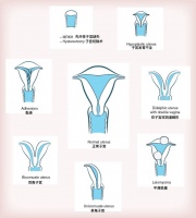 男人,你准备好自己生孩子了吗?