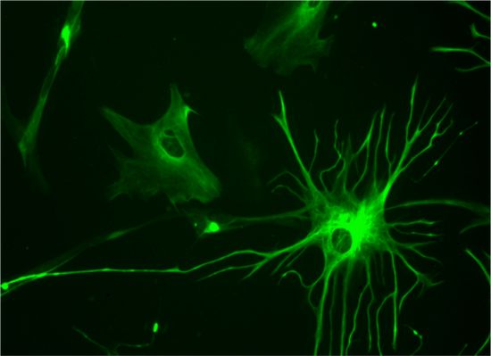 星形胶质细胞，可以为神经元提供营养。|维基百科