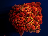 第3例艾滋病患者被“治愈”，人类终于能攻克艾滋病了吗？