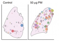 一年180万人死于肺癌,这一次科学家找到了预防关键