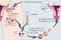 “做试管”，是一场漫长的“闯关游戏”