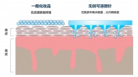 提供纳米级微针美容产品，「克奥妮斯Quanis」将透皮给药技术“降维”到家庭美妆领域