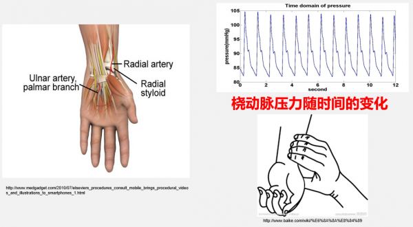 探索脉搏波的临床诊疗价值，「金姆健康」先从女性健康开始进行商业化