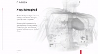关注预防性医疗保健领域,以色列医疗技术公司「Nanox」部署数字化医学成像系统