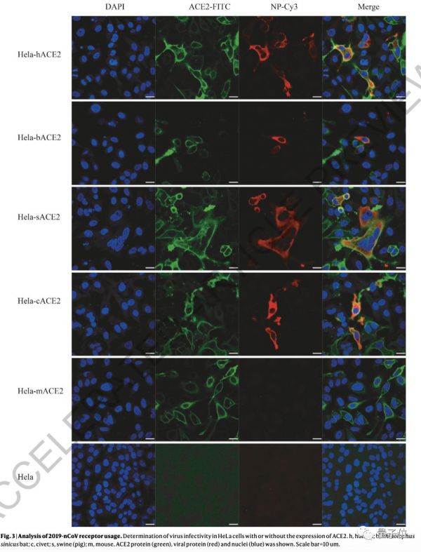 Nature首次、连发2篇新冠病毒论文：确认病毒进入细胞路径