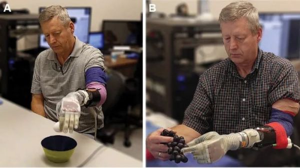 科幻般的技术，密歇根大学开发由大脑意识精密控制的假肢，还能玩「剪刀石头布」