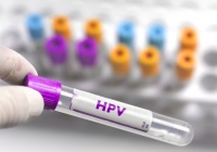 九价HPV疫苗厂商上市接力,亏损7亿多的康乐卫士冲刺北交所丨IPO速递